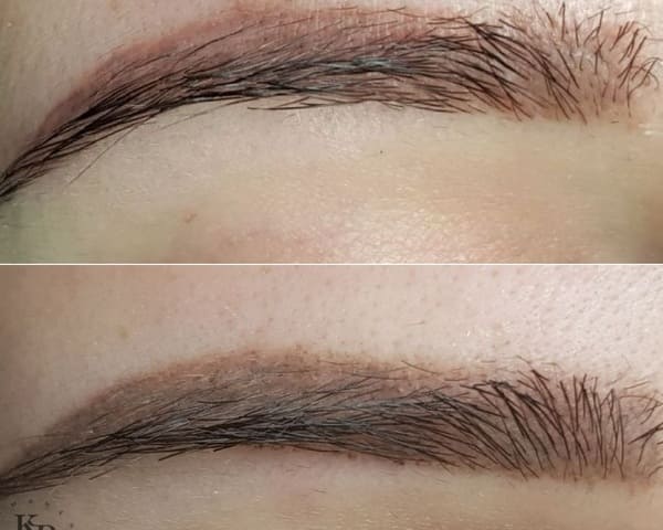 Перекрытие красных бровей. Красные брови после татуажа бровей или после микроблейдинга
не удаляются лазером они либо перекрываются корректорами либо выводятся ремувером