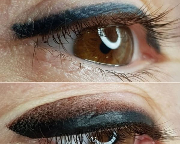 Перекрытие старых синих стрелок сразу после процедуры на стрелку с растушевкой