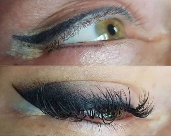 Удаление высветление старого татуажа стрелок. Перекрытие старых стрелок на стрелку с
растушевкой. Здесь использовался ремувер для высветления стрелок