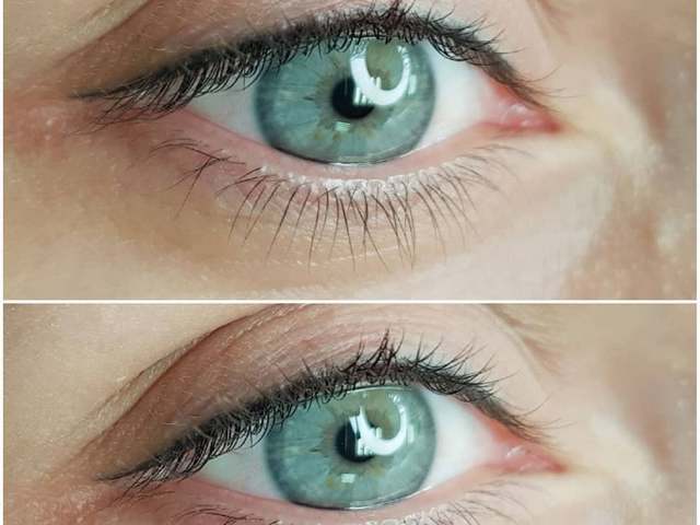 Заполнение межресничного пространства так выглядит зажившая межресничка через месяц